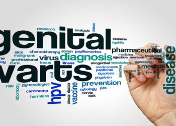 درمان زگیل تناسلی