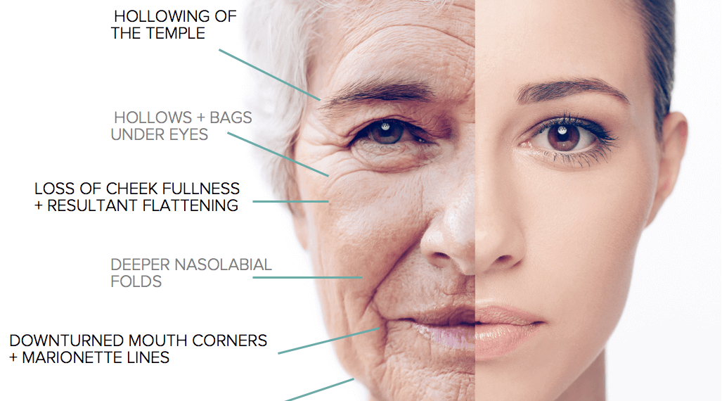 فیلرهای پوستی