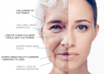 فیلرهای پوستی