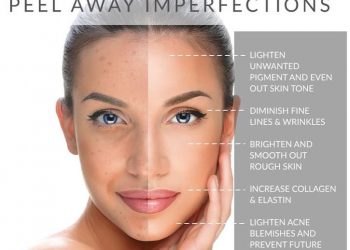 مندلیک اسید