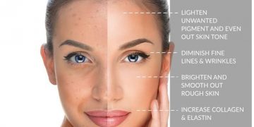 مندلیک اسید